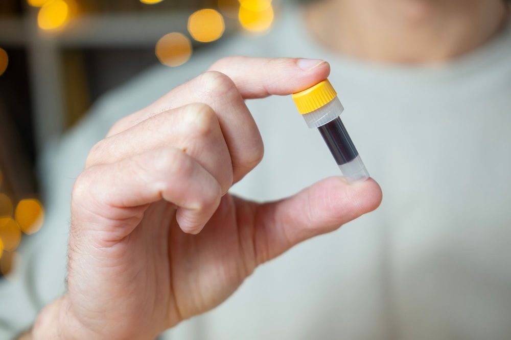 Hand holding small vial with liquid.