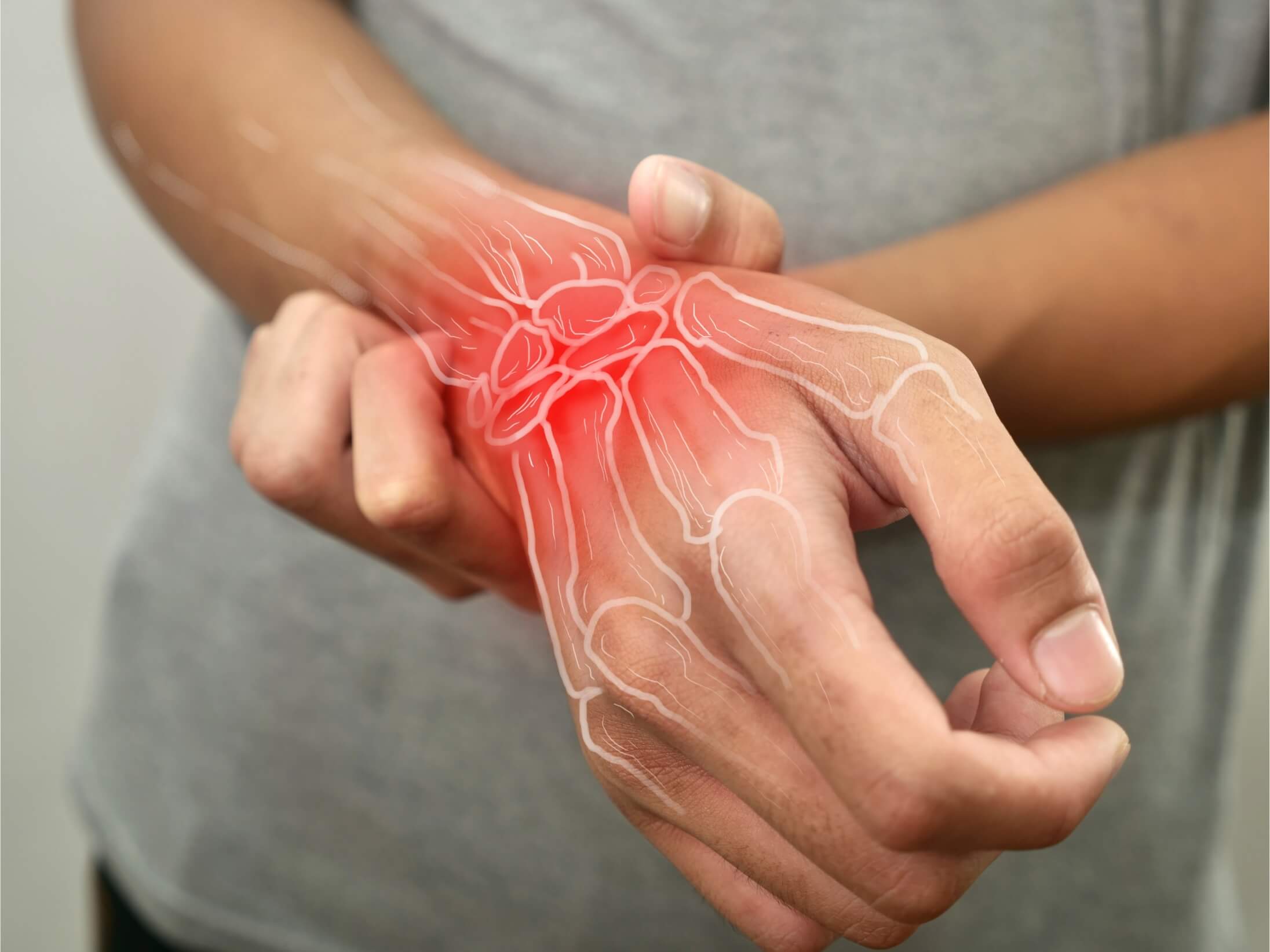 osteoporose